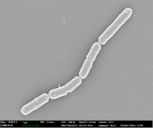 Bifidobacterium longum BORI